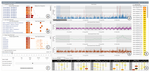 Visual Analytics for Decomposing Temporal Event Series of Production Lines